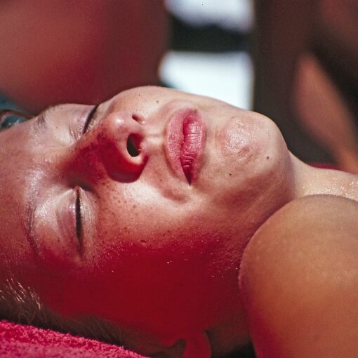 Melanoma e scottature solari: anche pochi episodi aumentano il rischio. Ecco gli errori da evitare
