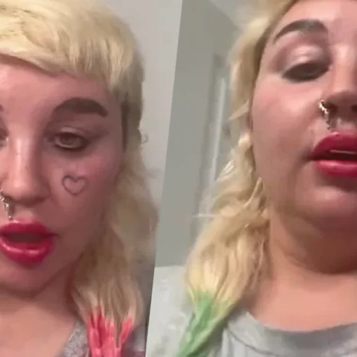 Amanda Bynes: biografia, crisi, rinascita e il discusso annuncio su Ozempic